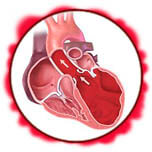 Сердечная недостаточность - патологические отклонения в сердце